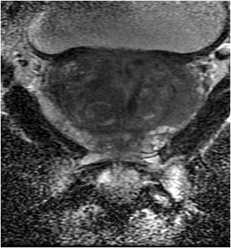 prostate_mri_7